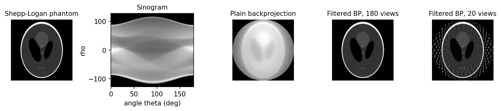Shepp-Logan phantom, its sinogram, a blurry plain backprojection, a sharp filtered backprojection from 180 views, and a streaky filtered backprojection from 20 views