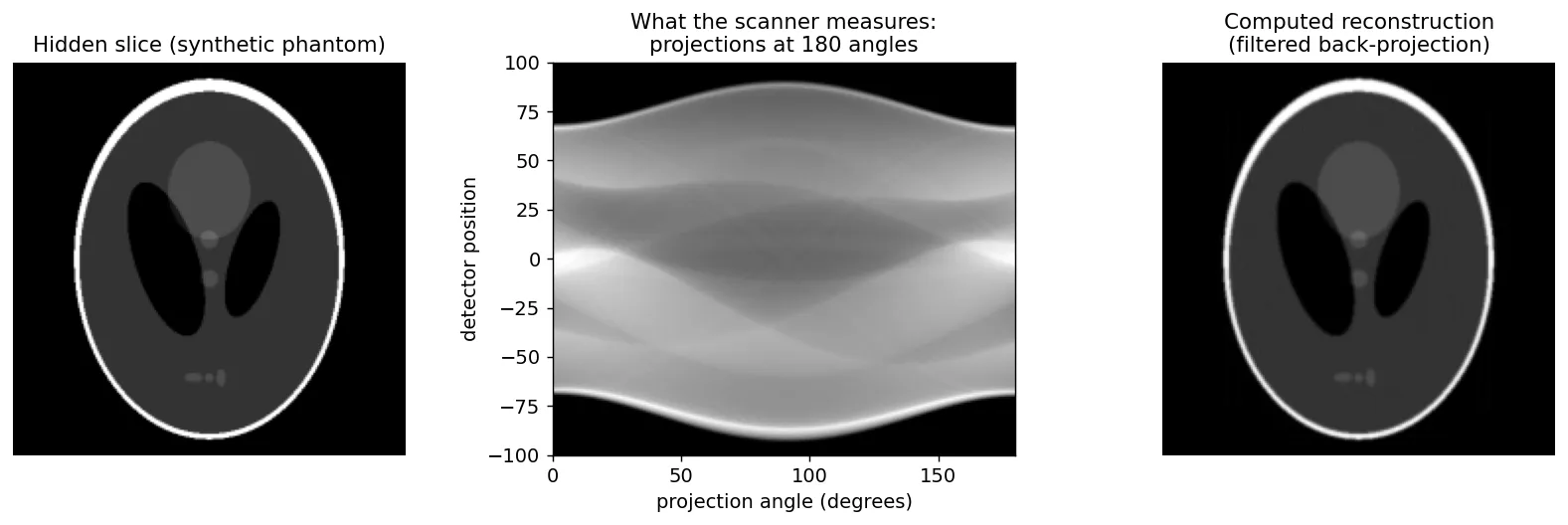 Three panels: a synthetic head phantom of ellipses, its sinogram showing sinusoidal traces over 180 projection angles, and the reconstructed slice which closely matches the original