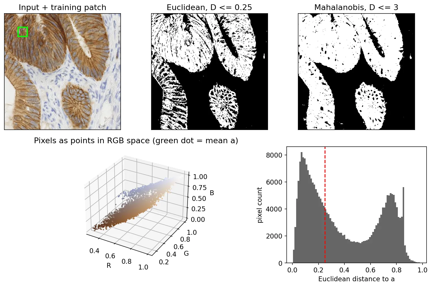 Immunohistochemistry image with a training patch, Euclidean and Mahalanobis segmentation masks, a 3-D scatter of pixels in RGB space, and a histogram of Euclidean distances